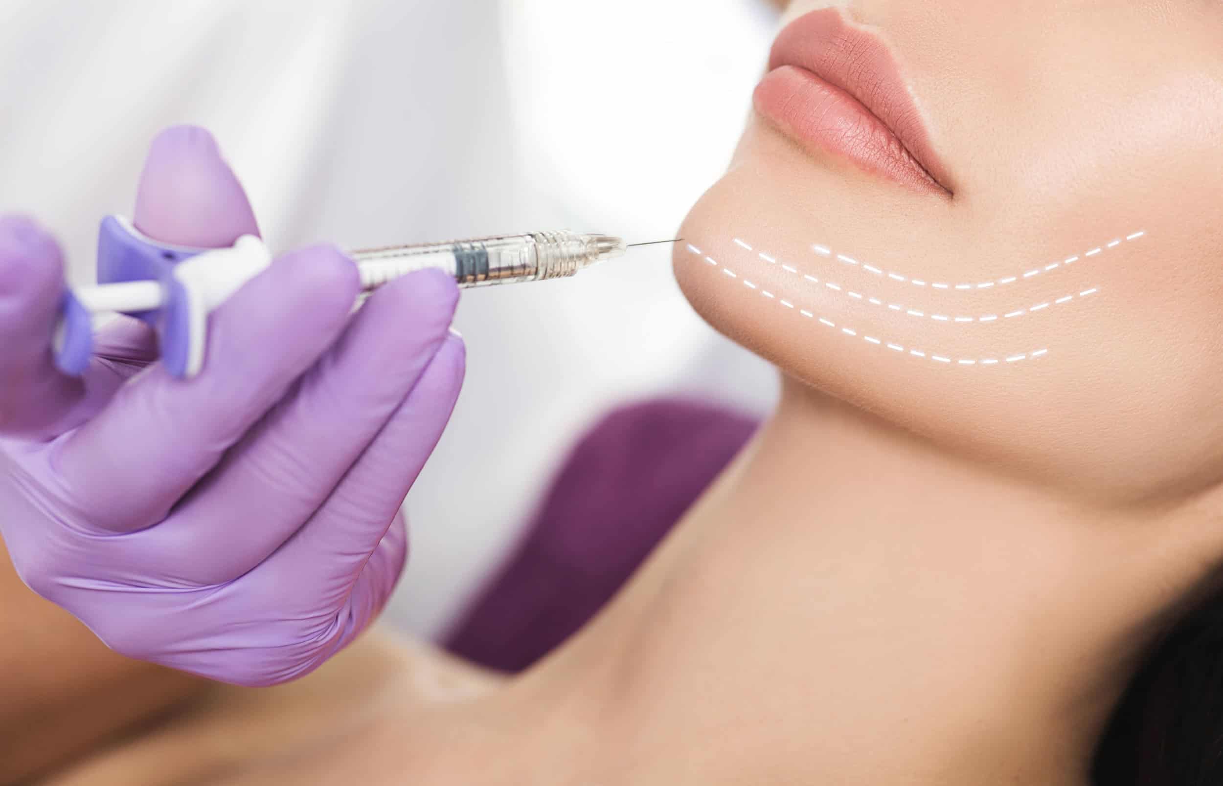 Woman getting Thread Lifts Treatment in her Jawline | Torstveit Medical Aesthetics in Phoenix, AZ