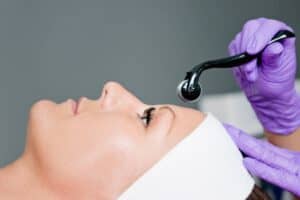 Scarlet RF Microneedling in Phoenix, Arizona | Torstveit Medical Aesthetics