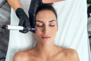 Microneedling in Phoenix, AZ by Torstveit Medical Aesthetics